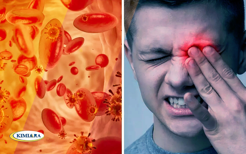 سردرد ناشی از کم خونی 2 سردرد ناشی از کم خونی