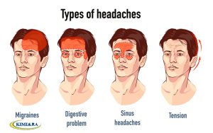 سردرد پیشانی