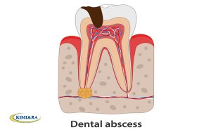 سردرد و دندان درد