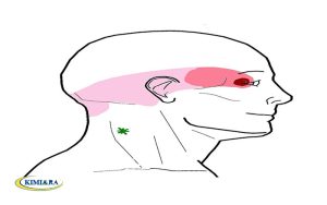 چشم درد و سردرد