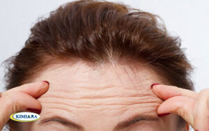 رفع چین و چروک پوست