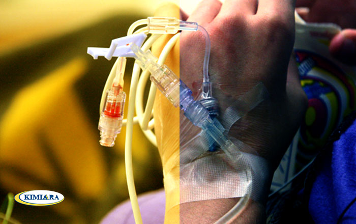 هر آنچه باید درباره شیمی درمانی بدانید