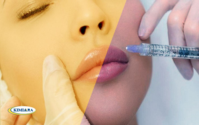 تکنیک تزریق ژل لب روسی چیست؟ 2 تکنیک تزریق ژل لب روسی چیست؟