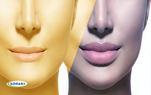 تکنیک تزریق ژل لب روسی چیست؟ 6 تکنیک تزریق ژل لب روسی چیست؟