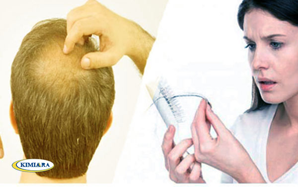 علت و درمان ریزش مو 2 علت و درمان ریزش مو