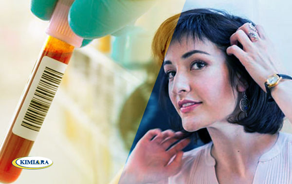 علت و درمان ریزش مو 5 علت و درمان ریزش مو