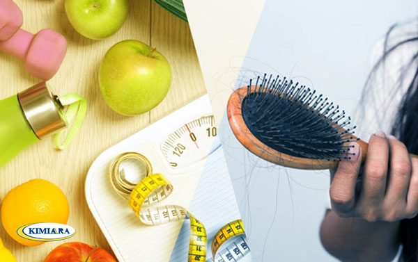 علت و درمان ریزش مو 7 علت و درمان ریزش مو