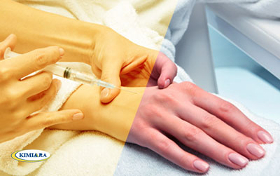 کاربردهای تزریق ژل در جوانسازی و درمان 3 تزریق ژل به دست و بازو جهت جوانسازی