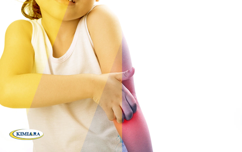 آیا آلرژی باعث تب در کودکان می شود؟ 2 تب و آلرژی در کودکان