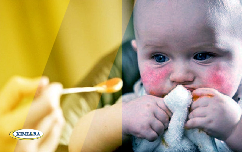 تب و آلرژی در کودکان