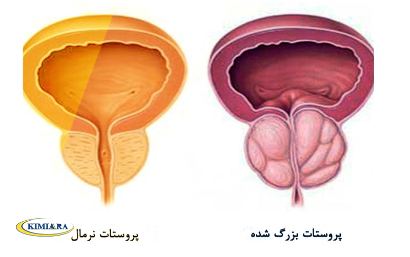 منیزیم چه خواصی برای مردان دارد؟ 4 خواص منیزیم برای مردان