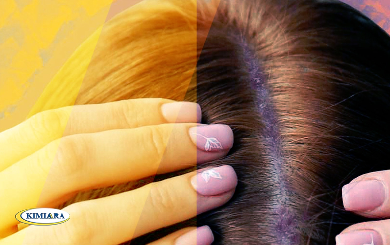 خواص منیزیم برای پوست و مو 4 خواص منیزیم برای پوست