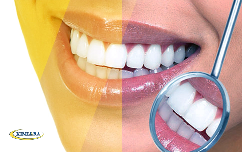 استحکام دندان