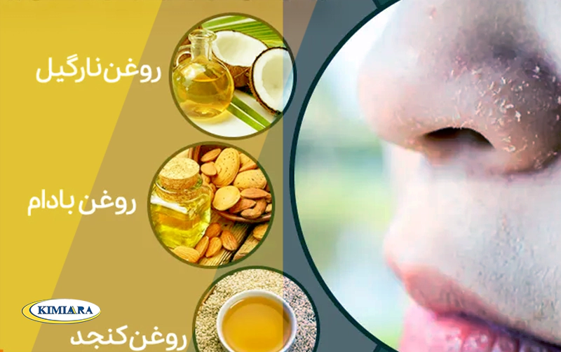 درمان قطعی خشکی بینی با اسپری بینی تسکین آلرژی بتادین 4 درمان خشکی بینی