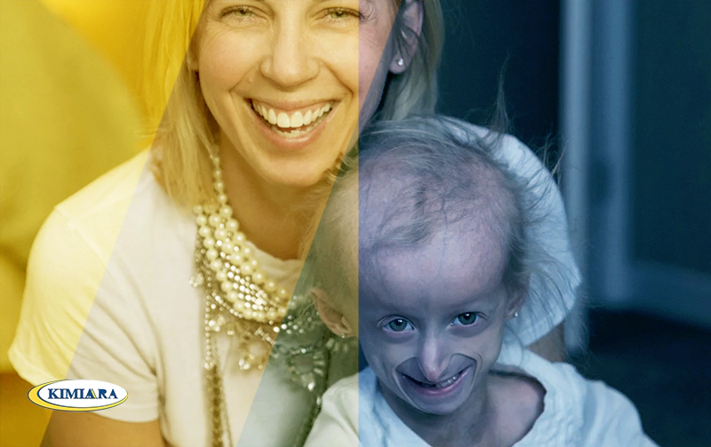 جلوگیری از پیری زودرس