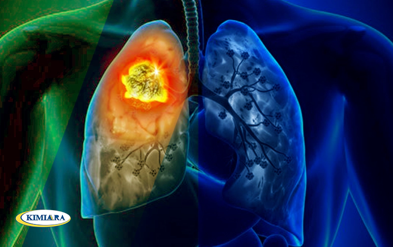 خستگی بعد از خواب را با چه روش های علمی درمان کنیم؟ 3 درمان خستگی بعد از خواب