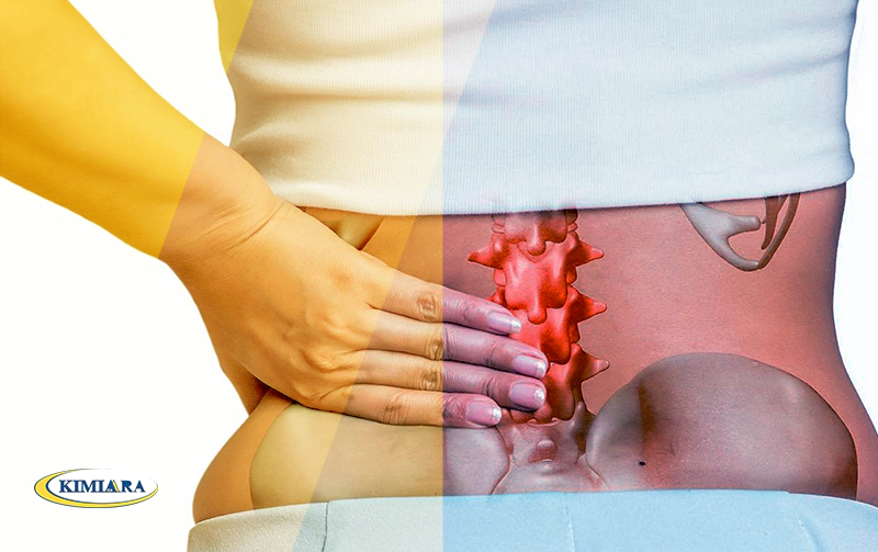 علت درد در ناحیه گودی کمر چیست؟ 1 علت درد در ناحیه گودی کمر