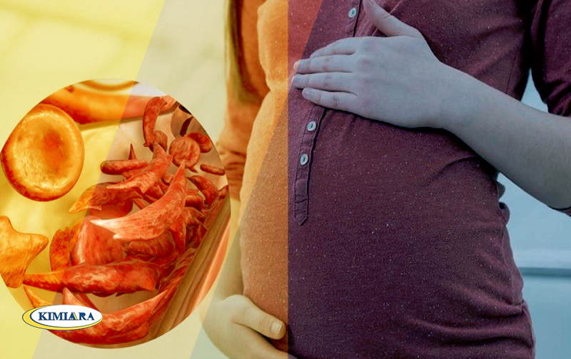 کم خونی در بارداری