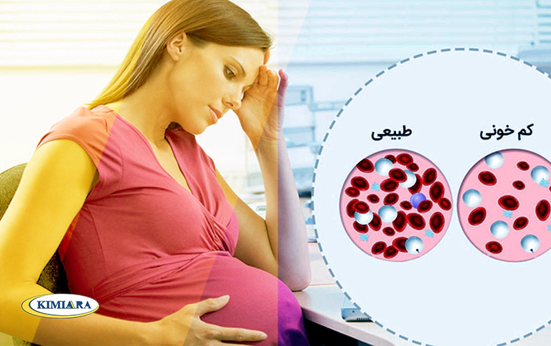 کم خونی در بارداری