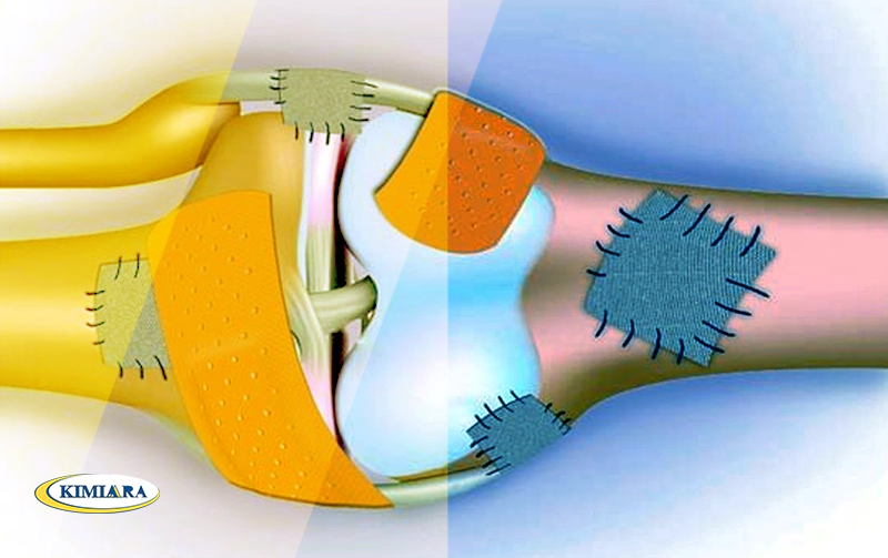 آیا پوکی استخوان قابل درمان است