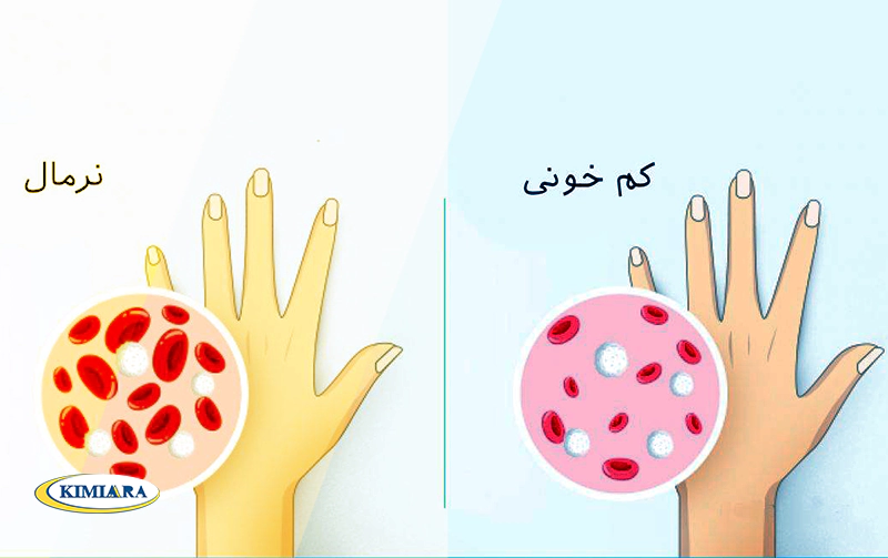 کم خونی چه خطراتی دارد