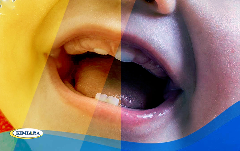 علایم کمبود کلسیم و راهکارهای درمان آن 4 علایم کمبود کلسیم