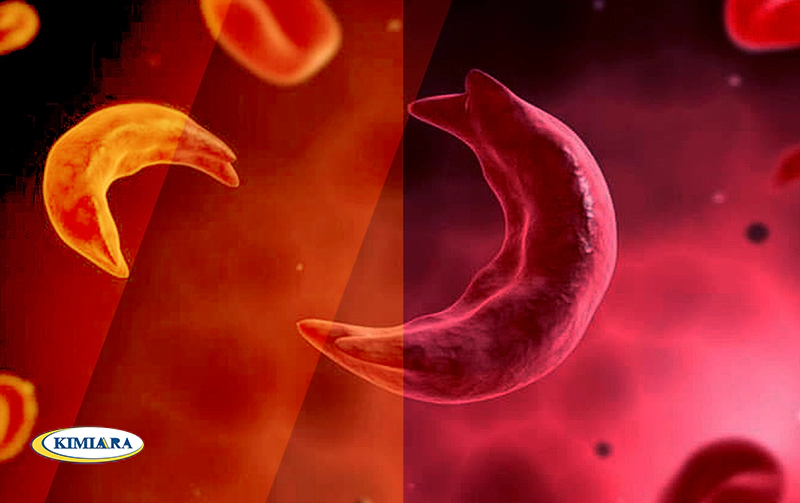 عوارض خطرناک کم خونی فقر آهن در نوجوانان 2 کم خونی فقر آهن در نوجوانان