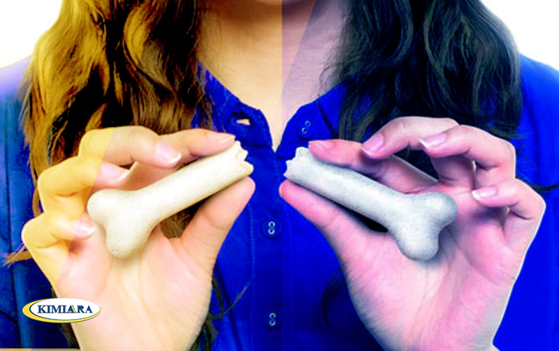 پوکی استخوان در زنان