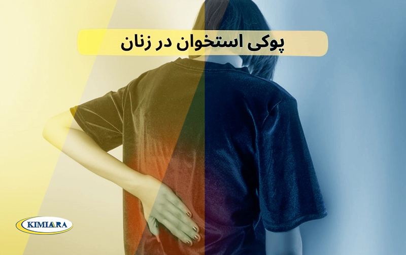 8 دلیل برای پوکی استخوان زودرس در زنان جوان 2 پوکی استخوان در زنان