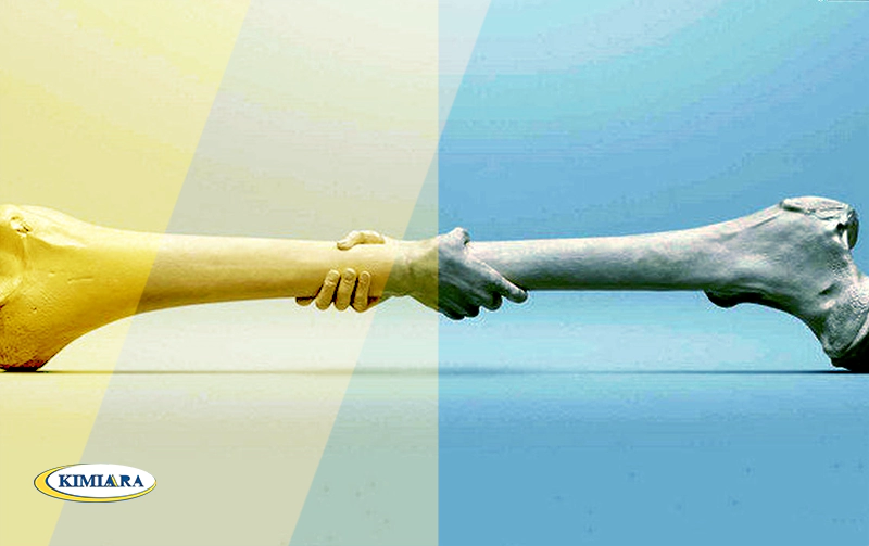 8 دلیل برای پوکی استخوان زودرس در زنان جوان 1 پوکی استخوان در زنان