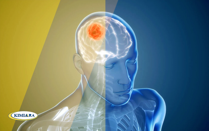 سردرد خطرناک