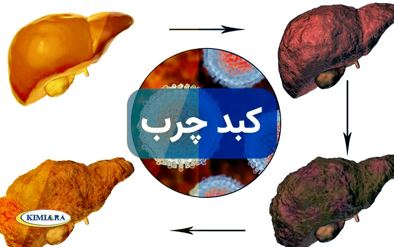 5 ویتامین و ماده معدنی مفید برای کبد چرب 2 کبد چرب