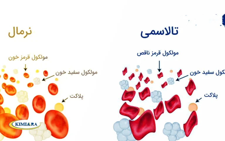 تفاوت تالاسمی و کم خونی