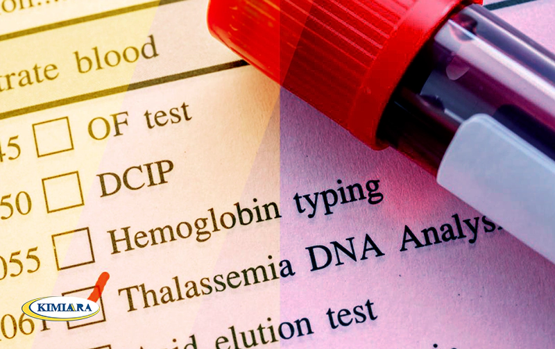 تفاوت کم خونی و تالاسمی چیست؟ 2 تفاوت کم خونی و تالاسمی
